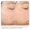 Picture of Salicylic Acid 2% Solution
